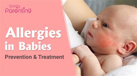Common Allergies in Babies and How to Handle Them - YouTube