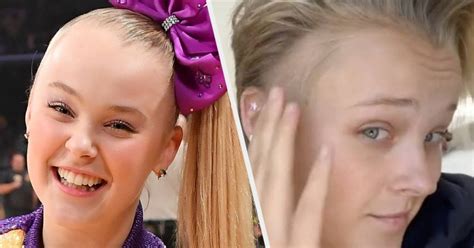 JoJo Siwa's Bald Spot And Stress Rash From Dance Moms - Ghanamma.com