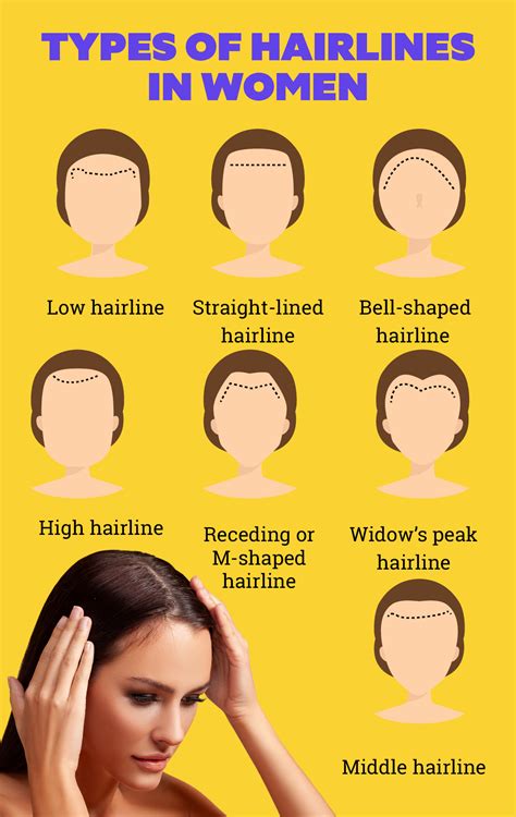 Different types of hairlines in women and how to take care of them