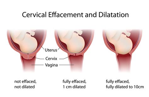 Your Dilating Cervix - The Gateway to Baby’s Birth - The Pulse