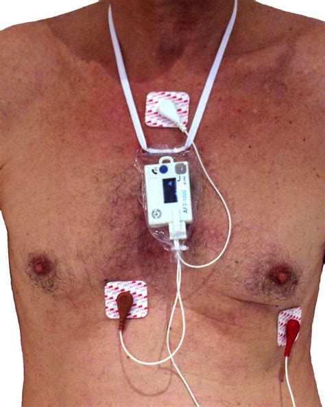 Holter monitor - Wikipedia
