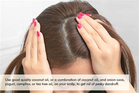 3 Hair Scalp Diseases That Coconut Oil Can Tackle