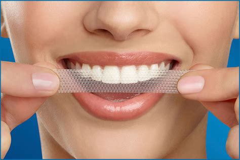 How Effective Are Teeth Whitening Strips? - Oris Dental Center