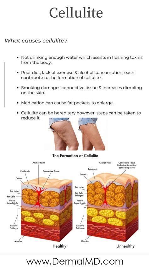 what causes cellulitis?