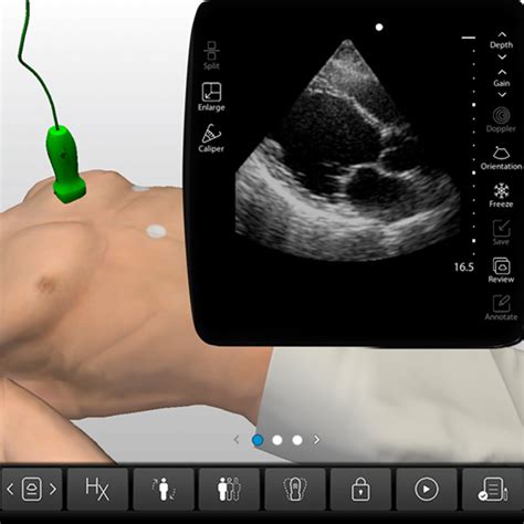 Cardiology Ultrasound Clinical Training - Pericardial Effusion