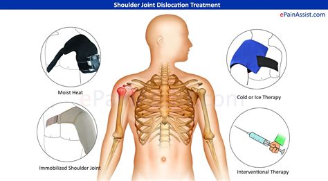 Shoulder Arthritis Symptoms Check more at http://www.nhprimecare.org ...