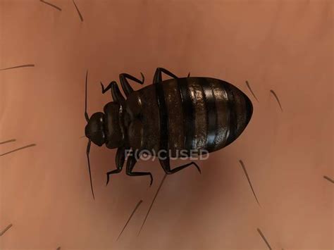 Parasitic Bedbug on human skin — entomology, illustration - Stock Photo ...