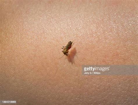 65 Asian Tiger Mosquito Bite Stock Photos, High-Res Pictures, and ...