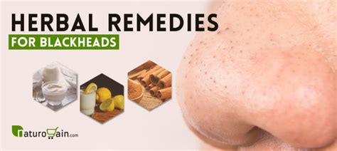 9 Simple and Best Home Remedies for Blackheads that Work [Fast]