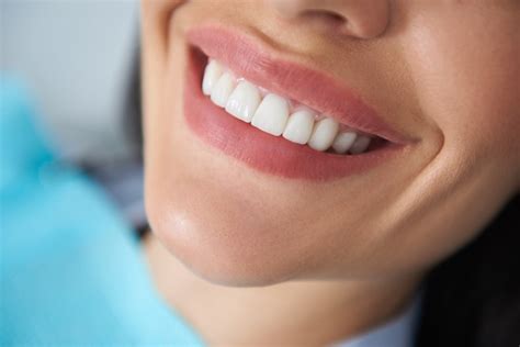 Dental Bonding: How to Restore Your Winning Smile - Dr Healthy Life