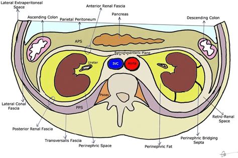 Radiological diagnosis of perinephric pathology: pictorial essay 2015 ...