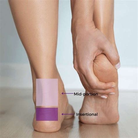 Achilles Tendinopathy: Causes, Symptoms & Treatment | The Feet People ...