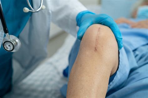 Knee Replacement Surgery in Singapore – Sports Knee Surgery