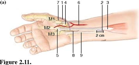 Figure 2.10 from Trapeziometacarpal Joint Arthritis | Semantic Scholar