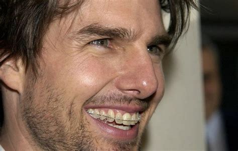 Tom Cruise Teeth Before And After : Celebrity Teeth Before And After ...