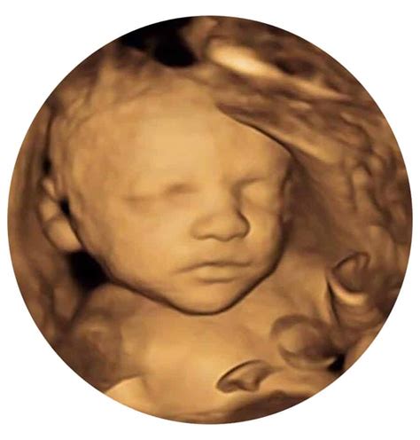 Window to the Womb Slough | 4D Scans Now Only £90