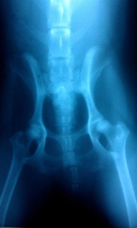 Ozzie's X-ray | Neon signs, Chd, Hip dysplasia