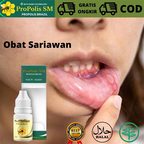 Jual Obat Herbal mengatasi sariawan dan Panas Dalam, Obat Sariawan ...