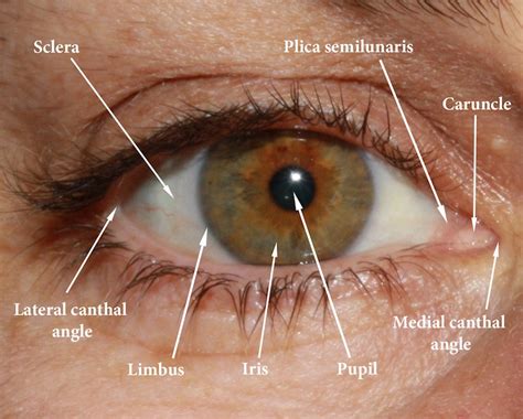 Socket anatomy - New Zealand Prosthetic Eye Service