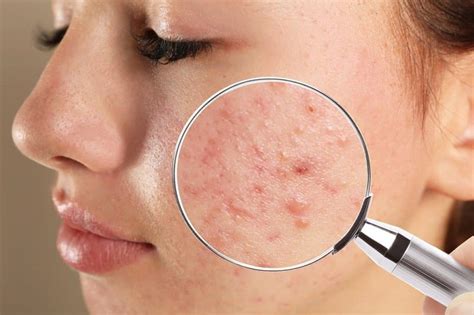 7 Common Skin Conditions and How To Fix Them | Beauty Courses Online