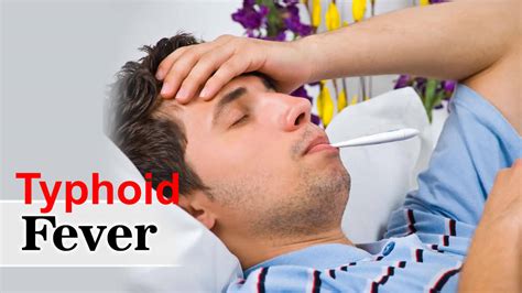 Typhoid fever causes, symptoms, prevention, vaccine, diagnosis & treatment