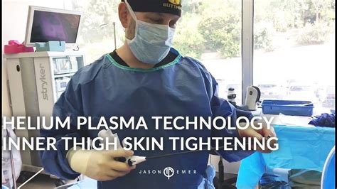 Inner Thigh Skin Tightening | Renuvion/J-Plasma | Hi-Definition Liposculpture | Thigh Lift - YouTube