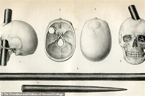 Meet the man who was shot in the head with an iron rod - and SURVIVED: Scientists reconstruct ...