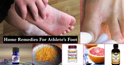 Home Remedies for Athlete's Foot HowRid - 2189