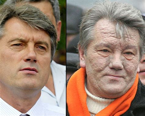 MOS: The Poisoning of Viktor Yushchenko