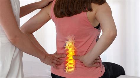 Loss Of Lumbar Lordosis Exercises