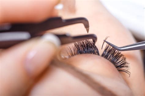 Madarosis (Eyelashes Falling Out): Causes, Symptoms, and Treatment