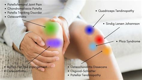 Knee Pain Location Chart | Learn the Pain Location of Knee Injuries