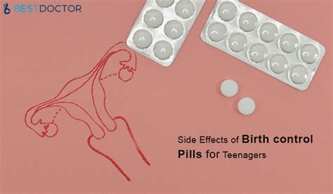 Side Effects of Birth control Pills for Teenagers