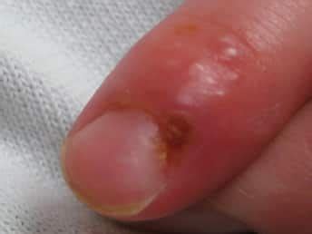 Skin Diseases: Symptoms, Causes,Treatments, and Prevention