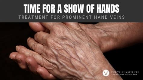 Treatment for Prominent Hand Veins - The Vein Institute at SSA