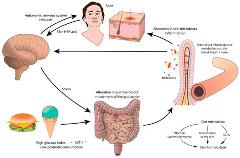 JCM | Free Full-Text | Potential Role of the Microbiome in Acne: A Comprehensive Review