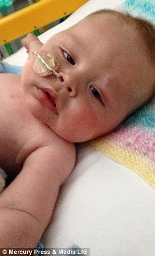 Baby with 'blueberry muffin' syndrome is diagnosed with leukaemia | Daily Mail Online