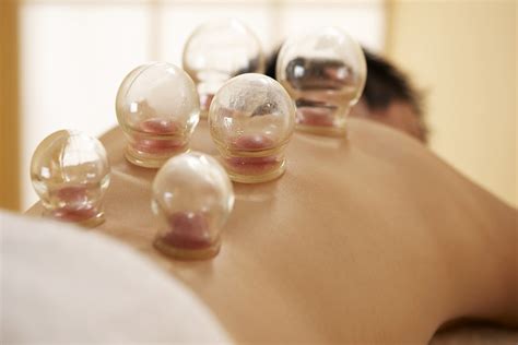 Authentic Hijama Cupping In Kerala By Dr Althaf Rana, Kerala | lupon.gov.ph