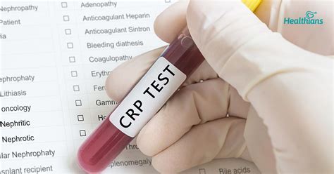 Understanding CRP Blood Test - Healthians Blog