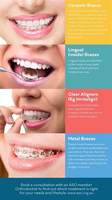 types of braces info straighten teeth without braces - Aneesha Shetty ...