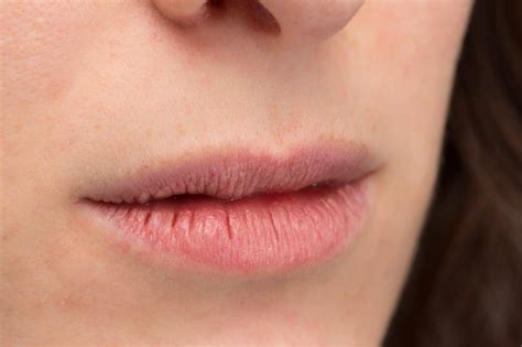 Winter Mouth Issues | Cracked Lips | Williamsburg Dental Williamsburg Dental