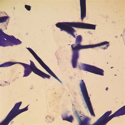 Ear Cytology: Sampling, Processing, and Microscopic Evaluation