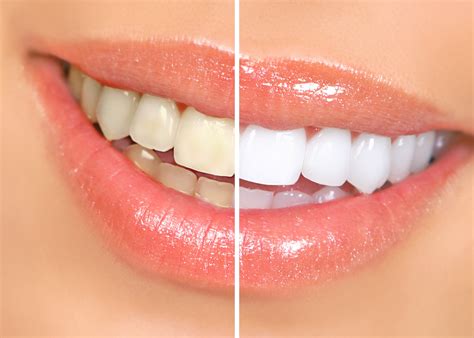 How To Use The Crest Whitening Strips With Light at ericlzeitler blog