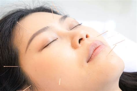 Facial Rejuvenation | Renew Acupuncture - Houston