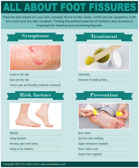 All About Foot Fissures | Skin ointment, Infographic, Ointment