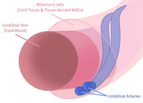 Umbilical Cord Blood Storage - Umbilical Cord Blood Banking/Preservation Cost - HealthBanks