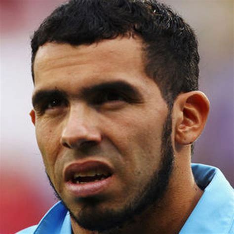 What Happened To Carlos Tevez Neck Scars