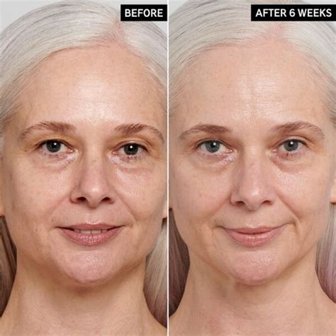 Retinol Before and After: Transform Your Skin with These Results - Must Read This Before Buying