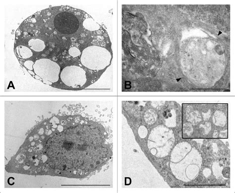 Electron micrographs showing the ultrastructure of MEF cells after... | Download Scientific Diagram