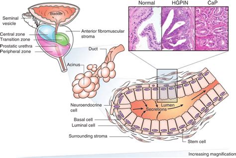 4 Schematic of the prostate from organ to glands (ducts and acini).... | Download Scientific Diagram